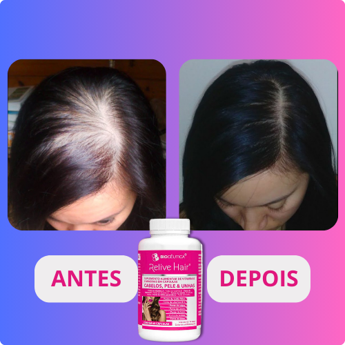 ANTES E DEPOIS