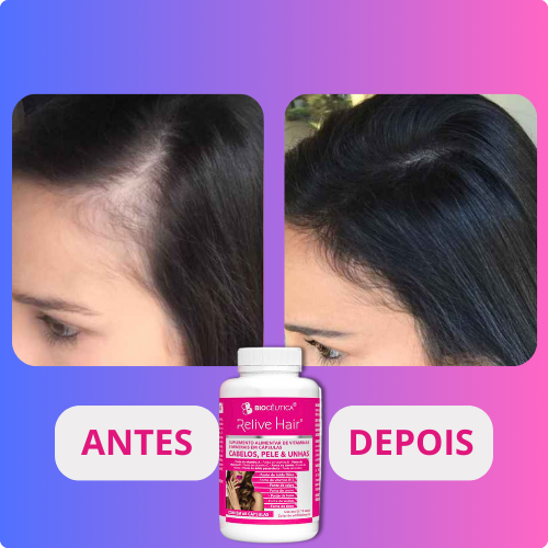 ANTES E DEPOIS2